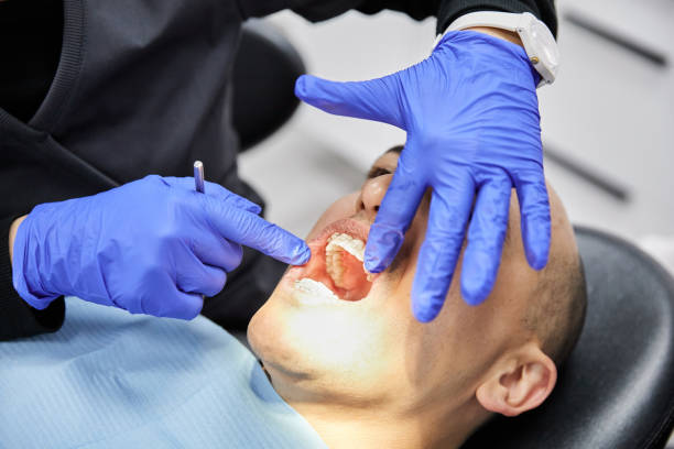 Best Emergency Tooth Extraction in Ortonville, MN